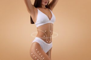 Conceptual image showing flank and waist fat reduction target areas for body contouring