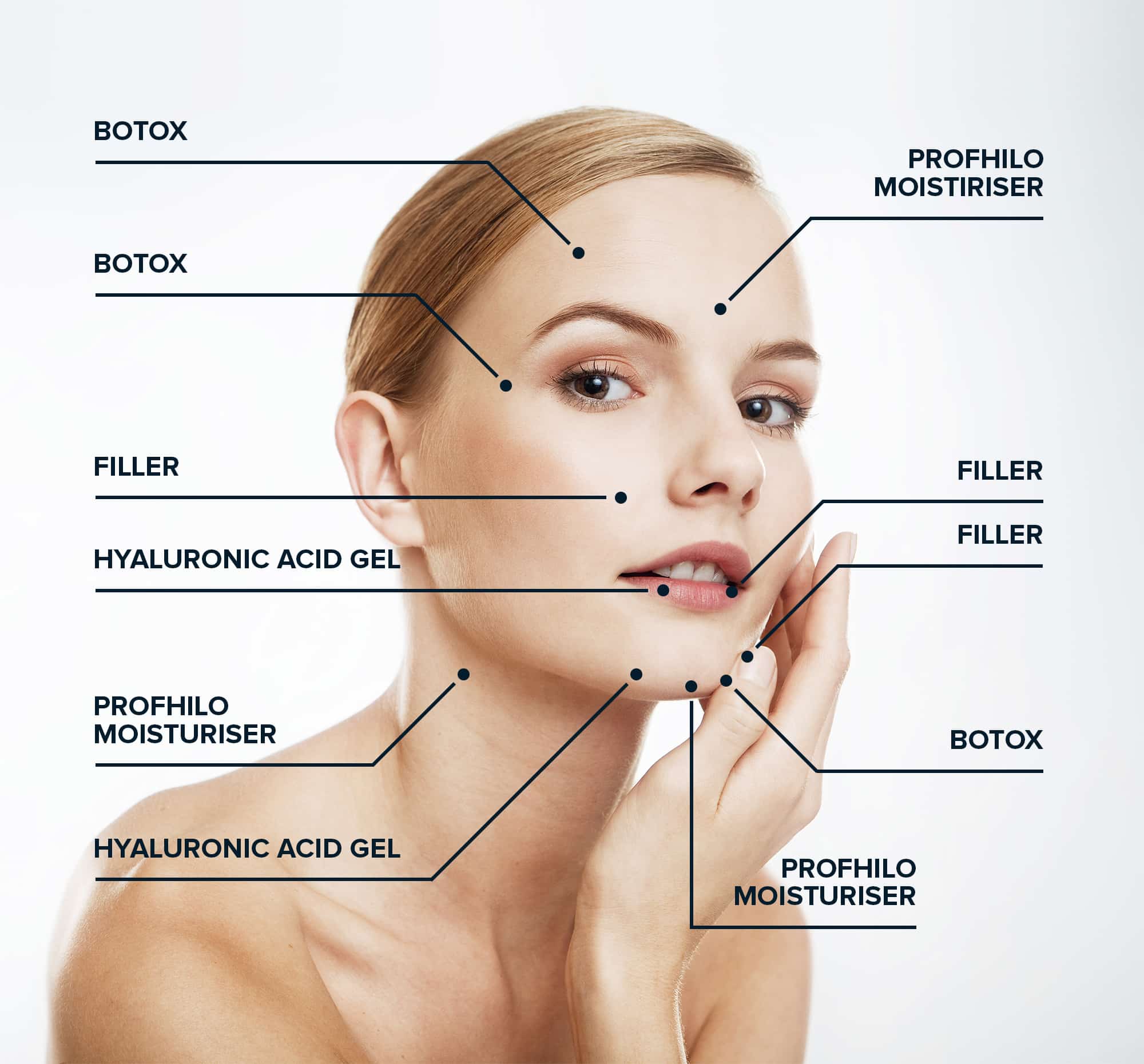 Illustration showing how Profhilo hyaluronic acid spreads through the skin during bio-remodelling treatment