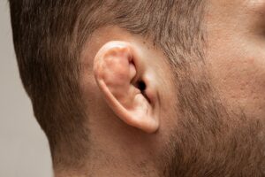 Damaged and broken cartilage of ear. Most famous injury for wrestlers and fighters.