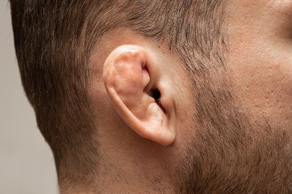 Damaged and broken cartilage of ear. Most famous injury for wrestlers and fighters.