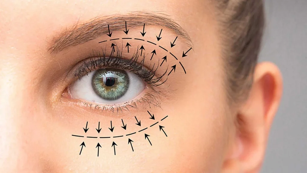 featured-image-blog-blepharoplasty-1